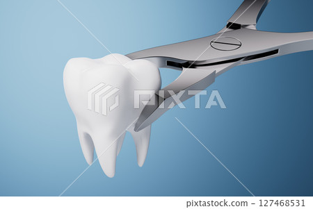 dent, whitening, root 127468531