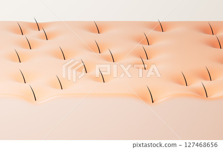 Skin with hair in pores, hair treatment concept, Skin with hair in pores, hair treatment concept, 127468656