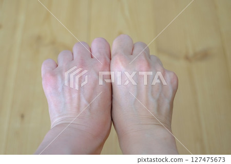 40多歲女性的血管 127475673