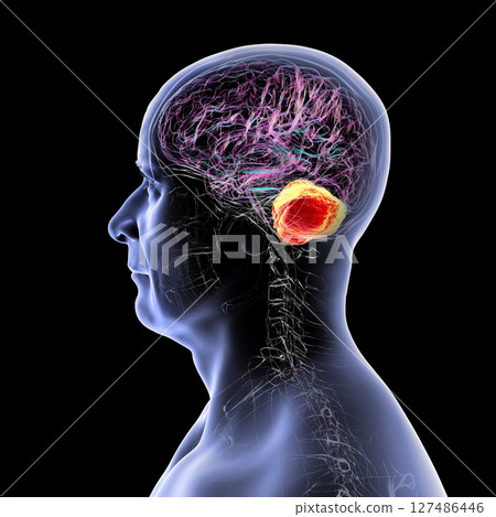 Human brain with highlighted cerebellum, 3D illustration. Cerebellum is responsible for coordination, balance, and fine motor control. Damaged in ataxia and neurodegenerative disorders 127486446