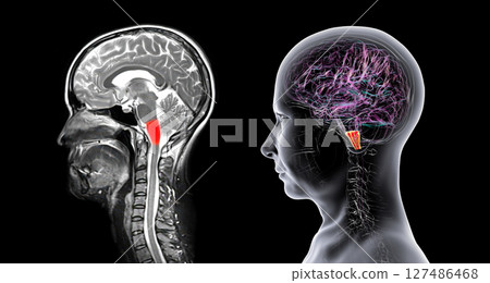 Medulla oblongata highlighted in human brain, composite colored MRI and 3D illustration. Controls breathing, heartbeat, and other vital autonomic functions 127486468