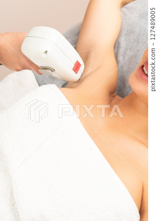 Close-up of laser hair removal underarms. Close-up of laser hair removal underarms. 127489005
