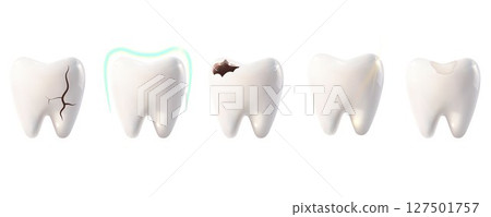 A set of healthy and damaged teeth. A tooth with a crack, filling, caries, and protection. Dentistry, dental care, orthodontics, oral health concept. 3D vector illustration on a white background. 127501757