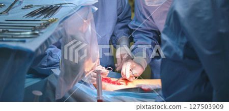 Closeup of doctors hands operating a patient conducting open cut surgery in surgical room. Healthcare and medical intervention concept 127503909
