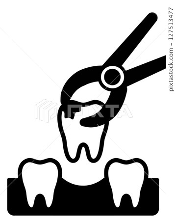 Tooth extraction "AI generated images" 127513477