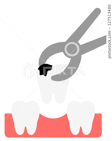 Tooth extraction "AI generated images" 127513480