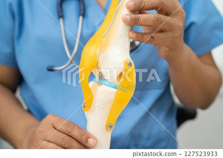 Osteoarthritis of the knee, Doctor holding human knee joint orthopedic anatomy model in hospital. 127523933