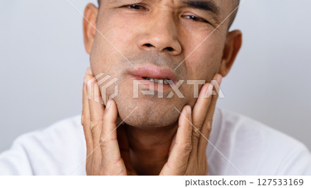 Man has facial swelling due to an allergic reaction to triggers such as insect bites, food Man has facial swelling due to an allergic reaction to triggers such as insect bites, food 127533169