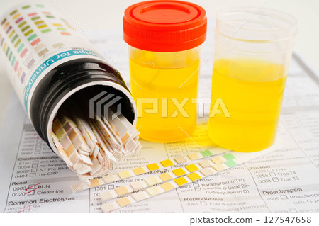 Urinalysis, urine cup for check health examination in laboratory. 127547658