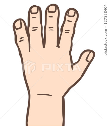 Acromegaly enlarged hands Acromegaly enlarged hands 127558404