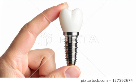 Implant image Implant image 127592674