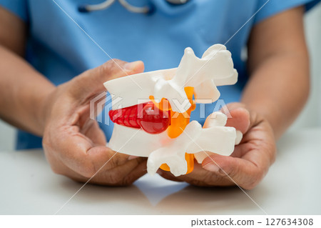 Asian doctor holding spinal nerve and bone model, Lumbar spine displaced herniated disc fragment for treatment medical in the orthopedic department. Asian doctor holding spinal nerve and bone model, Lumbar spine displaced herniated disc fragment for treatment medical in the orthopedic department. 127634308