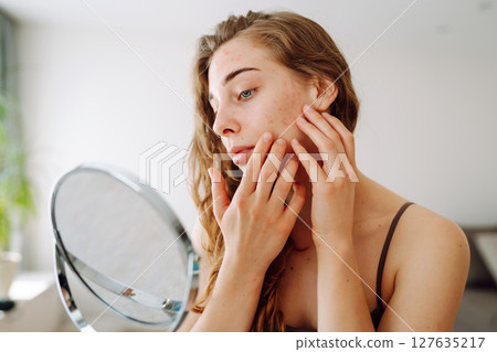 Beautiful woman with problematic skin looks in her small mirror. Cosmetology. Skin care concept. Beautiful woman with problematic skin looks in her small mirror. Cosmetology. Skin care concept. 127635217