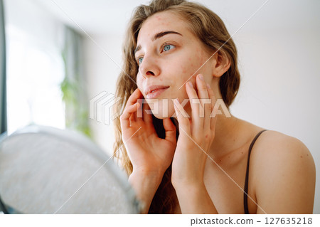 Beautiful woman with problematic skin looks in her small mirror. Cosmetology. Skin care concept. 127635218