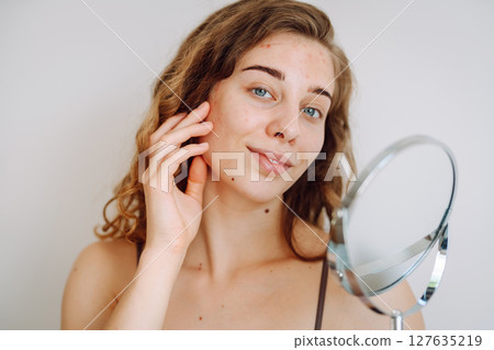 Beautiful woman with problematic skin looks in her small mirror. Cosmetology. Skin care concept. Beautiful woman with problematic skin looks in her small mirror. Cosmetology. Skin care concept. 127635219
