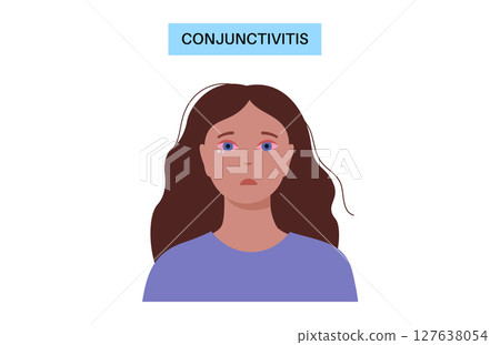 Conjunctivitis medical poster Conjunctivitis medical poster 127638054