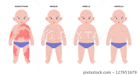 The most common viral rashes The most common viral rashes 127651679
