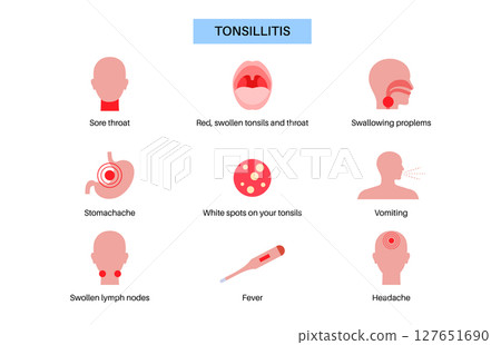 Tonsillitis Oral Desease Tonsillitis Oral Desease 127651690