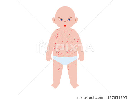 The most common viral rashes The most common viral rashes 127651795