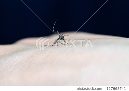 Hands with mosquito bites Hands with mosquito bites 127668741