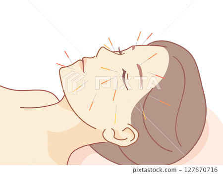 美容針灸插圖 127670716