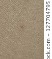 Skin, eczema, close-up 127704795