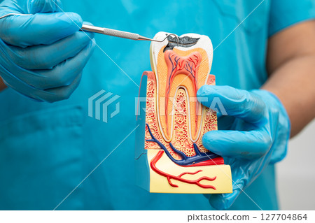 Asian dentist holding dental implant, artificial tooth roots into jaw, root canal of dental treatment, gum disease, teeth model for dentist. 127704864