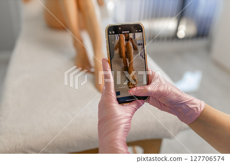 girl takes a photo on her smartphone of her smooth and beautiful legs after laser hair removal 127706574