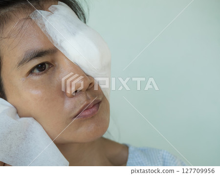 Pterygium Surgery Eye Medical Health, Medicine Care Patient After Pterygium Excision of Doctor Oculist Hospital, Woman use Wet Wipes Clean Face,Old Human Problem Vision Disease Lens Iris from Wind. 127709956