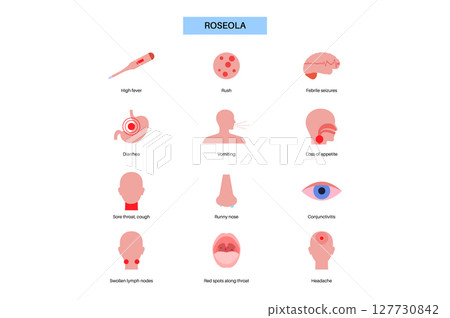 Roseola or exanthem subitum 127730842