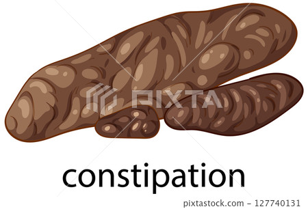Medical Illustration of Constipation Symptoms Medical Illustration of Constipation Symptoms 127740131