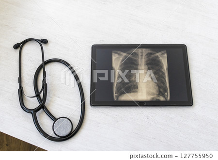 Table with phonendoscope, and a X ray image of the lungs with pneumonia on the tablet 127755950