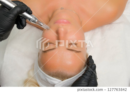 Microneedle RF lifting procedure. A cosmetologist performs a facial rejuvenation procedure on a woman. Hardware cosmetology. 127763842