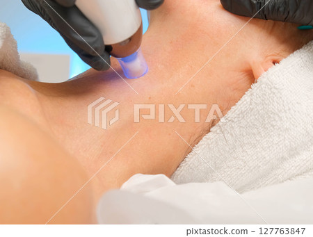 Close-up portrait of a beautiful aged woman during microneedling with dermapen from a beautician. Close-up portrait of a beautiful aged woman during microneedling with dermapen from a beautician. 127763847