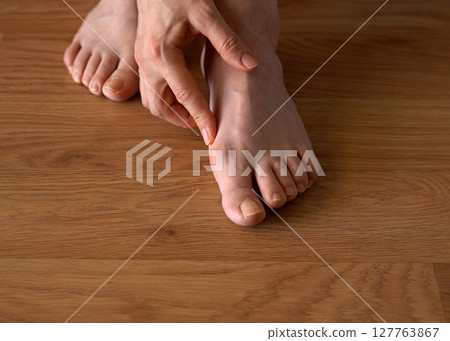 Close-up of a woman s foot with hallux valgus bunion and signs of toenail fungus. Her hand gently touches the deformed big toe, illustrating common foot problems and the need for medical care. Close-up of a woman s foot with hallux valgus bunion and signs of toenail fungus. Her hand gently touches the deformed big toe, illustrating common foot problems and the need for medical care. 127763867