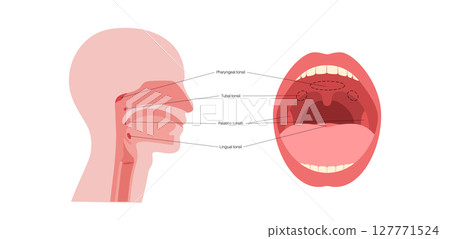 Adenoid medical poster 127771524