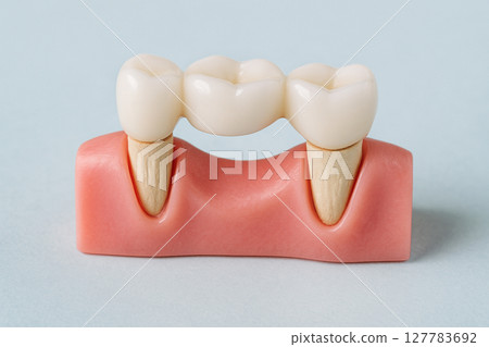 Bridges, dentures, denture treatment 127783692