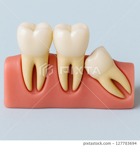智齒與相鄰牙齒接觸 127783694