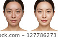 Comparison image of a woman with many blemishes and a woman with beautiful skin and no blemishes 127786273