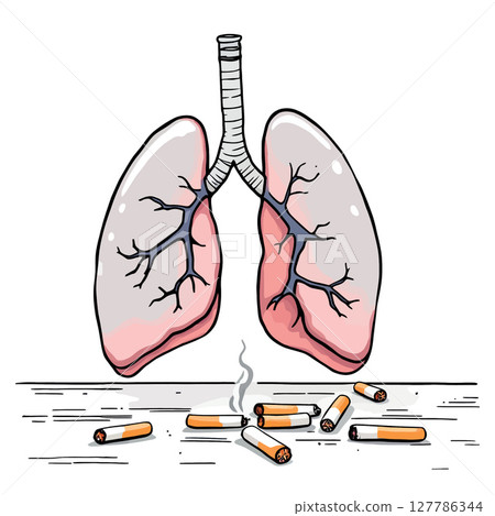 Vsai diseased lungs suffering from cigarette smoking addiction 127786344