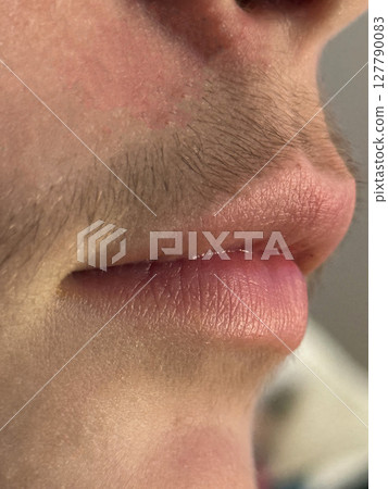 Close-Up of Lips and Upper Lip Hair on Male Face 127790083