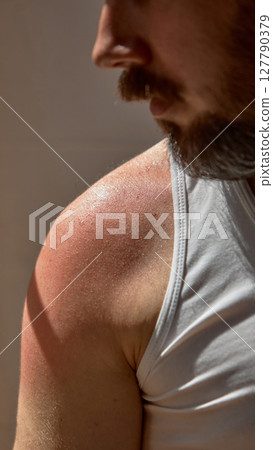 Skin-realism. Sun-kissed man shoulder, visible tan lines and real pores. Natural beauty 127790379