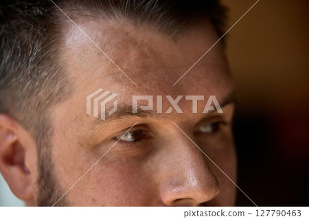 Inclusive beauty. Man with visible skin features, birthmark, looks calmly away from camera. Inclusive beauty. Man with visible skin features, birthmark, looks calmly away from camera. 127790463