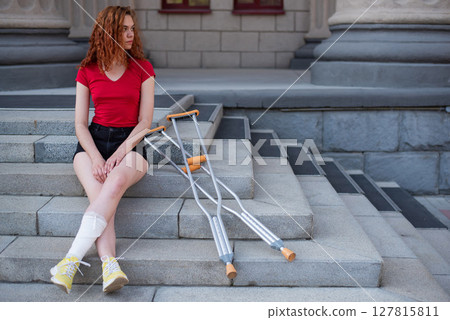 Young red-haired woman in shorts moves with crutches outdoors. 127815811