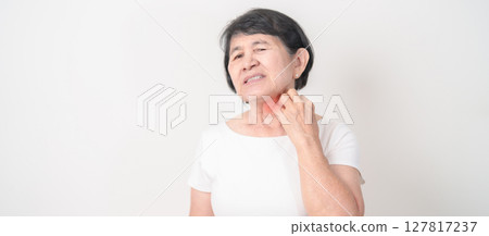 Elderly woman itching Neck and body scratching for Skin Allergy from insect bite and food dermatitis. Dermatology, Leprosy day, Systemic lupus erythematosus, Psoriasis, Urticaria and rash Eczema 127817237