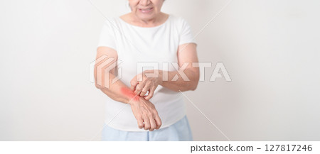 Elderly woman itching arm and body scratching for Skin Allergy from insect bite and food dermatitis. Dermatology, Leprosy day, Systemic lupus erythematosus, Psoriasis, Urticaria and rash Eczema 127817246