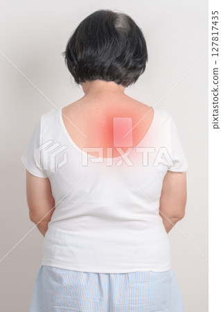 Business woman having back ache with Medicated pain relief patch plaster for Back Muscle Strain, Scapular Muscle Tightness, Piriformis Syndrome, Osteoporosis, Spinal Compression and Health care Business woman having back ache with Medicated pain relief patch plaster for Back Muscle Strain, Scapular Muscle Tightness, Piriformis Syndrome, Osteoporosis, Spinal Compression and Health care 127817435