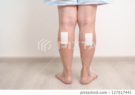 Elderly woman having Calf pain with Medicated pain relief patch plaster for concepts of Calf Muscle Strain, muscle pull, Leg Cramp, Sprain, aches, Varicose Veins, Deep Vein and world Thrombosis day 127817441