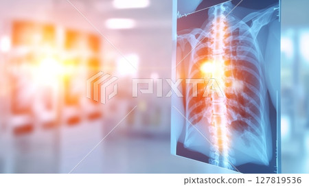 X ray image highlighting the spinal column and chest area under examination in a hospital setting, indicating a potential medical issue needing further investigation 127819536