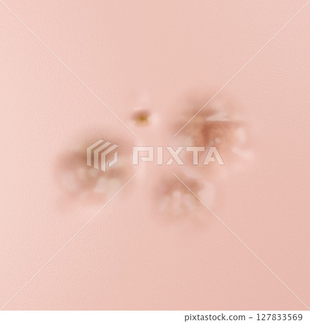 3D illustration of cosmetic dermatology with the theme of treating acne scars and cratered skin 127833569